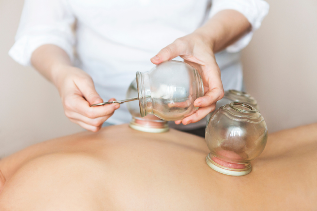 Cupping Therapy at Purity Acupuncture & Holistic Wellness in Asheville, NC