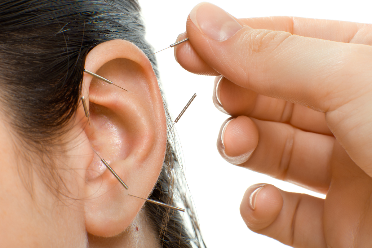 Auricular Ear Acupuncture at Purity Acupuncture & Holistic Wellness in Asheville, NC